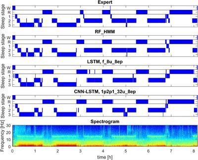 Automatic Human Sleep Stage Scoring Using Deep Neural Networks